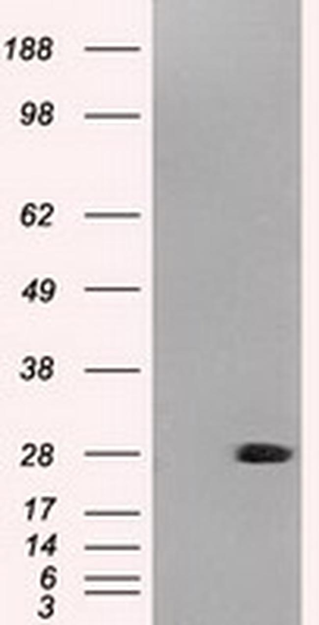 NEUROG1 Antibody in Western Blot (WB)