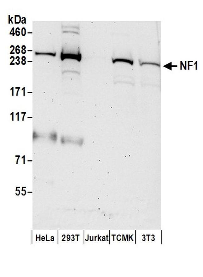 NF1 Antibody in Western Blot (WB)