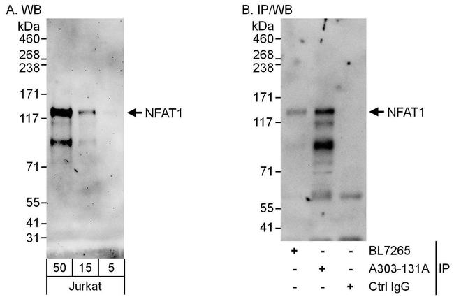 NFAT1 Antibody in Western Blot (WB)