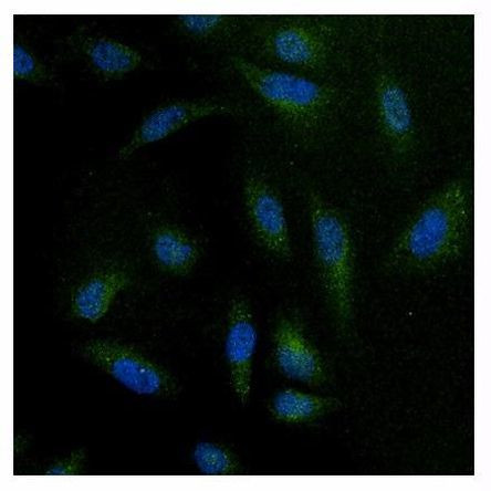 NFATC4 Antibody in Immunocytochemistry (ICC/IF)