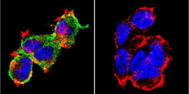 NFATC1 Antibody in Immunocytochemistry (ICC/IF)