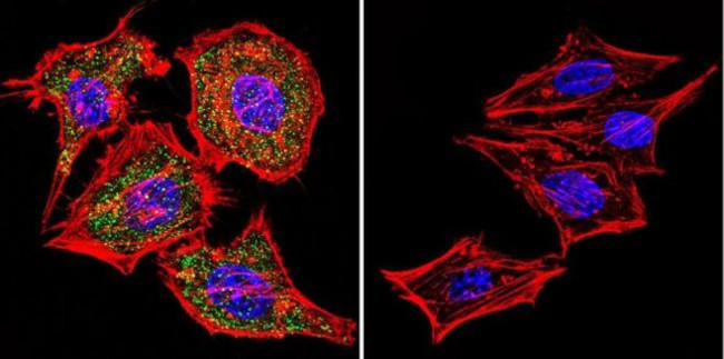 NFATC1 Antibody in Immunocytochemistry (ICC/IF)