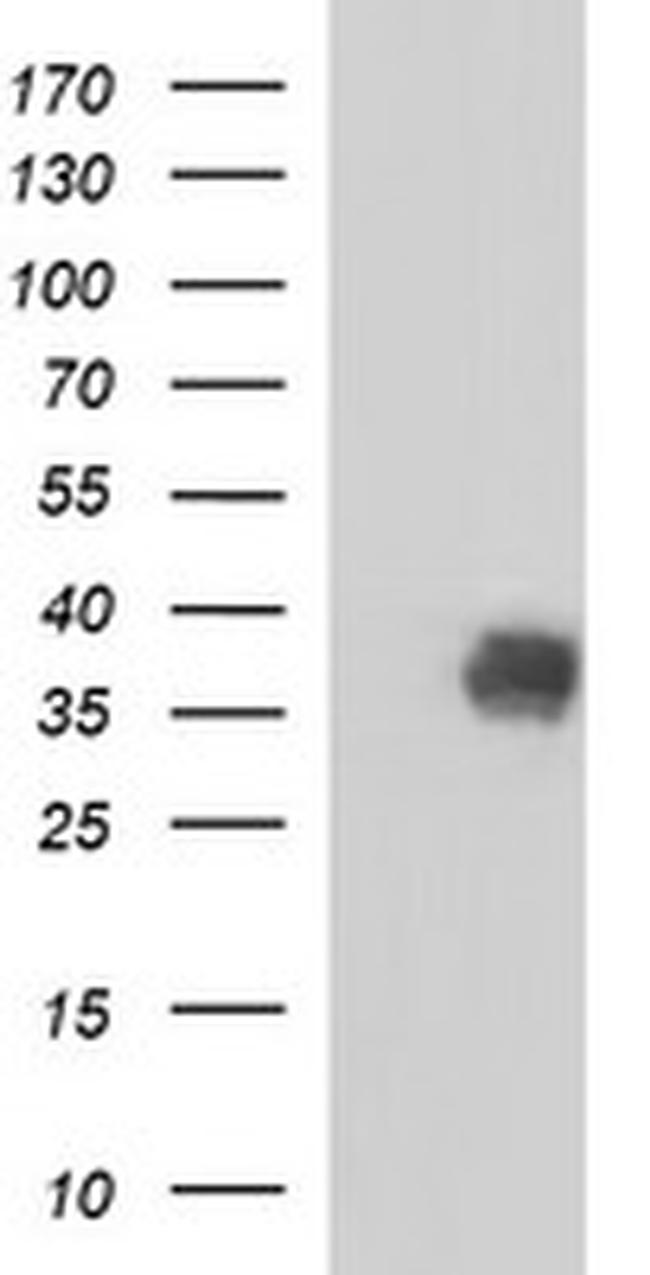 NFKBIA Antibody in Western Blot (WB)