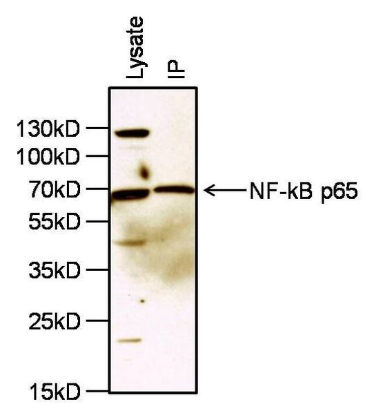 NFkB p65 Antibody in Immunoprecipitation (IP)