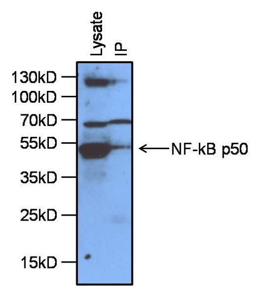 NFkB p65 Antibody in Immunoprecipitation (IP)