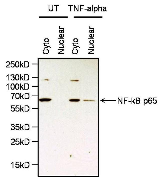 NFkB p65 Antibody in Western Blot (WB)