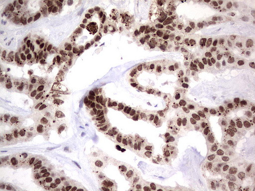 NHEJ1 Antibody in Immunohistochemistry (Paraffin) (IHC (P))