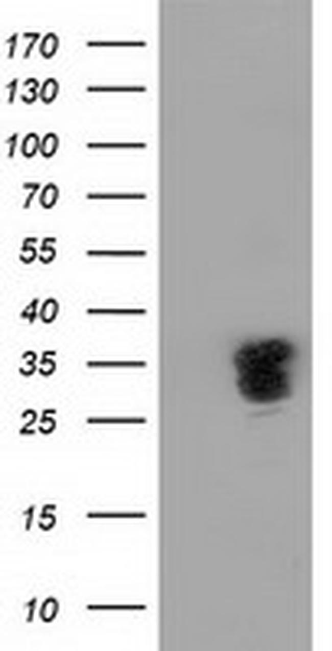 NHEJ1 Antibody in Western Blot (WB)