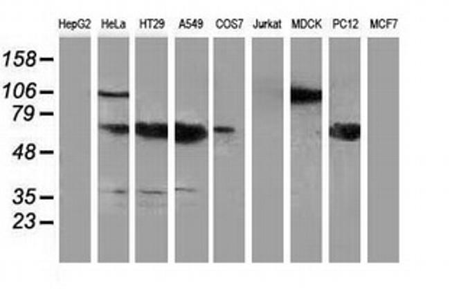 NHEJ1 Antibody in Western Blot (WB)