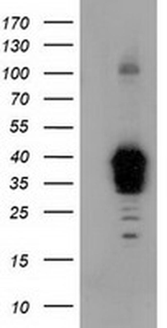 NHEJ1 Antibody in Western Blot (WB)