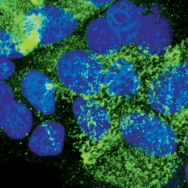 EBP50 Antibody in Immunocytochemistry (ICC/IF)