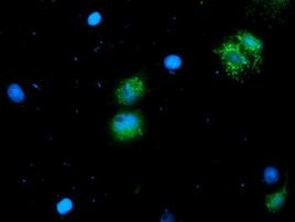 NIF3L1 Antibody in Immunocytochemistry (ICC/IF)