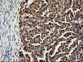 NIF3L1 Antibody in Immunohistochemistry (Paraffin) (IHC (P))