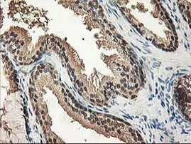 NIF3L1 Antibody in Immunohistochemistry (Paraffin) (IHC (P))