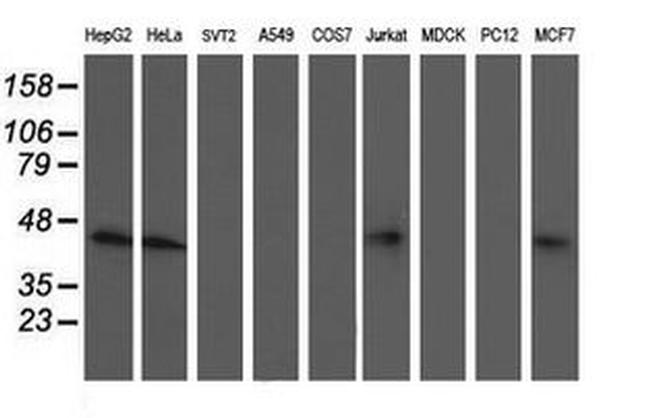 NIF3L1 Antibody in Western Blot (WB)