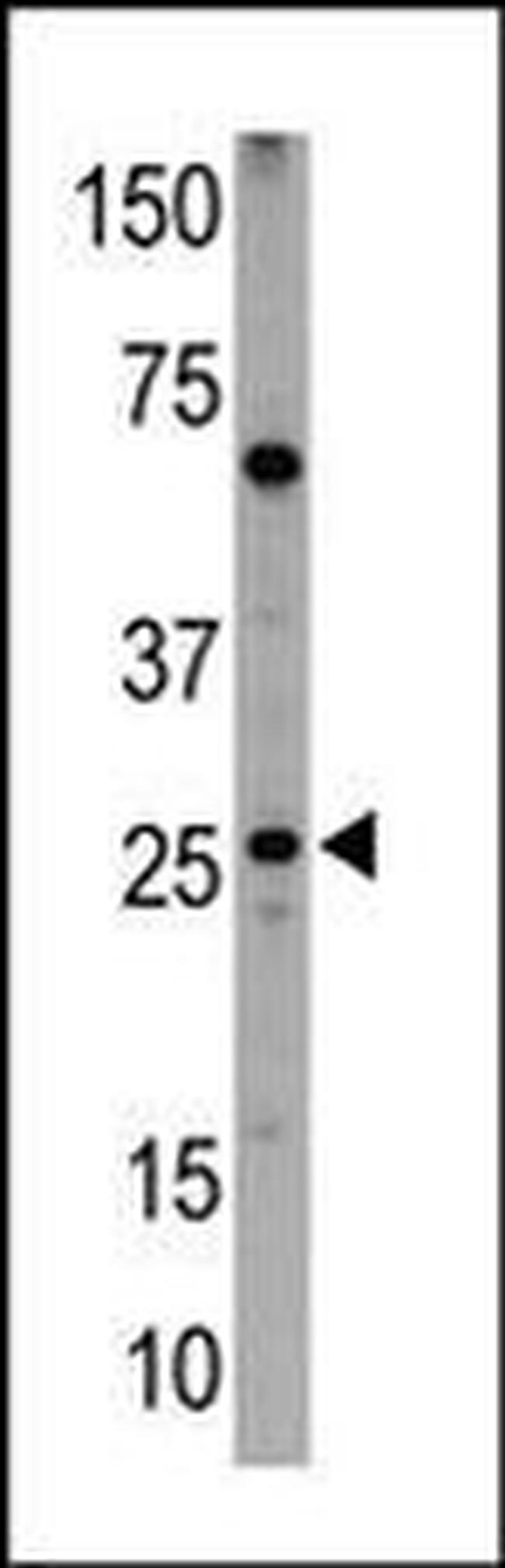 BNIP1 Antibody in Western Blot (WB)