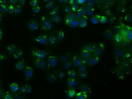 NIT1 Antibody in Immunocytochemistry (ICC/IF)