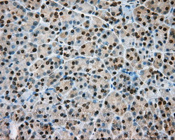 NIT1 Antibody in Immunohistochemistry (Paraffin) (IHC (P))