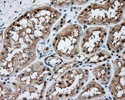 NIT1 Antibody in Immunohistochemistry (Paraffin) (IHC (P))