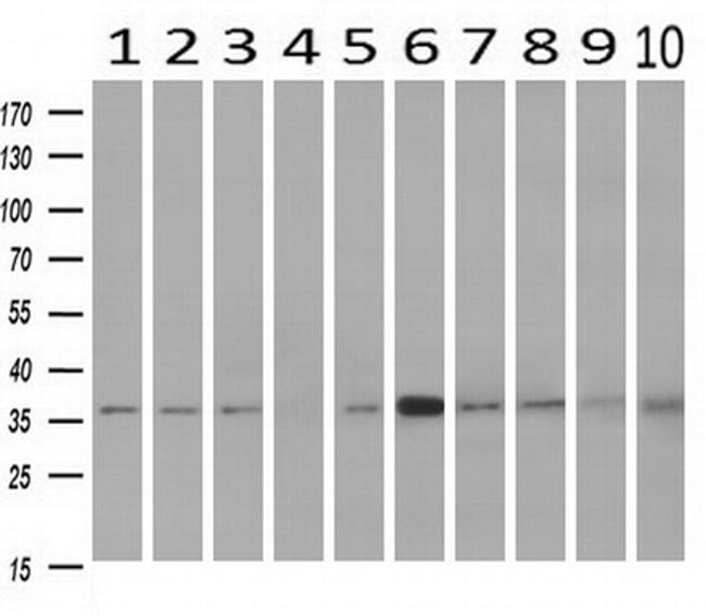 NIT1 Antibody in Western Blot (WB)