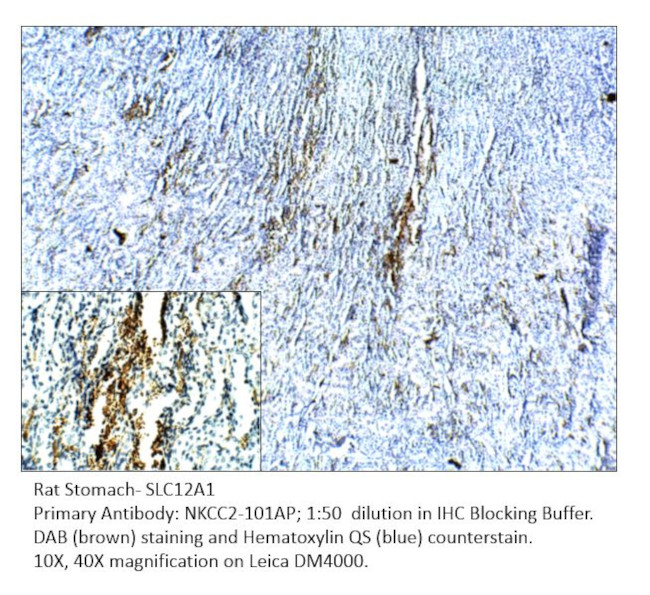 SLC12A1 Antibody in Immunohistochemistry (Paraffin) (IHC (P))