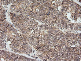 NKIRAS1 Antibody in Immunohistochemistry (Paraffin) (IHC (P))