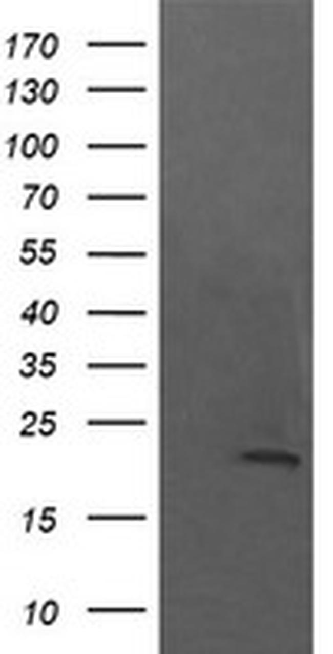 NKIRAS1 Antibody in Western Blot (WB)