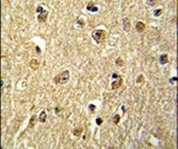 NKRF Antibody in Immunohistochemistry (IHC)