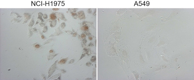 NKX2 Antibody in Immunocytochemistry (ICC/IF)