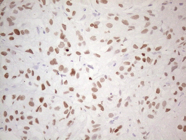 NKX2 Antibody in Immunohistochemistry (Paraffin) (IHC (P))