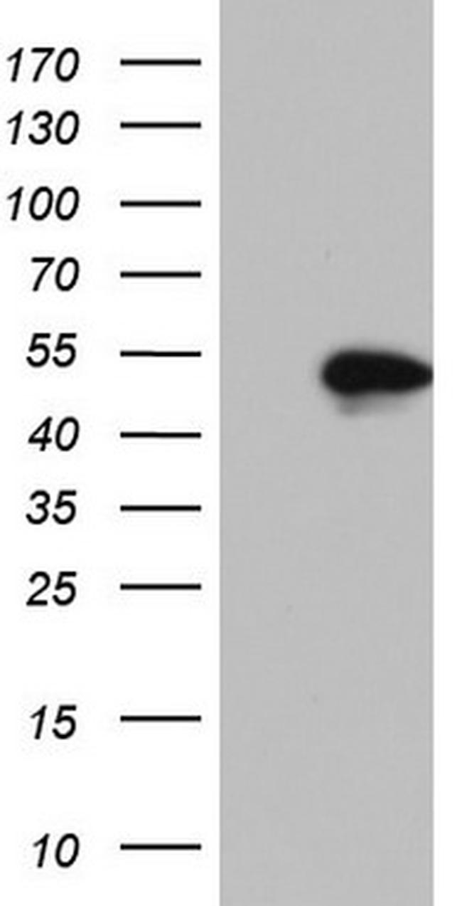 NKX2 Antibody in Western Blot (WB)