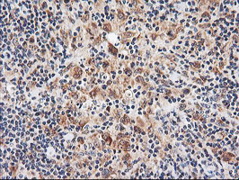 NLN Antibody in Immunohistochemistry (Paraffin) (IHC (P))