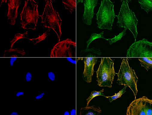 NME1 Antibody in Immunocytochemistry (ICC/IF)