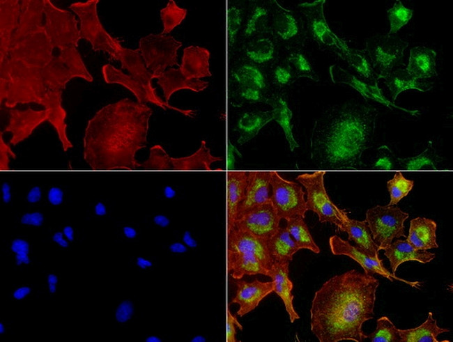 NME1 Antibody in Immunocytochemistry (ICC/IF)