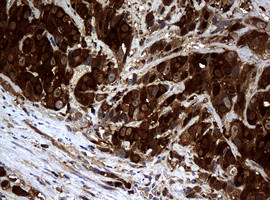 NME1 Antibody in Immunohistochemistry (Paraffin) (IHC (P))