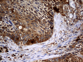 NME1 Antibody in Immunohistochemistry (Paraffin) (IHC (P))