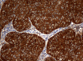 NME1 Antibody in Immunohistochemistry (Paraffin) (IHC (P))