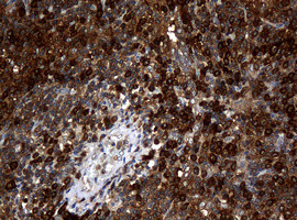 NME1 Antibody in Immunohistochemistry (Paraffin) (IHC (P))