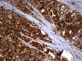 NME1 Antibody in Immunohistochemistry (Paraffin) (IHC (P))