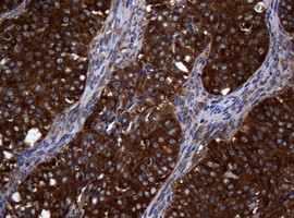 NME1 Antibody in Immunohistochemistry (Paraffin) (IHC (P))