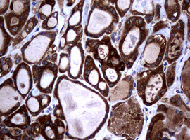 NME1 Antibody in Immunohistochemistry (Paraffin) (IHC (P))