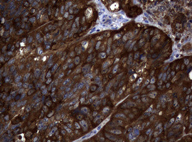 NME1 Antibody in Immunohistochemistry (Paraffin) (IHC (P))