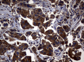 NME1 Antibody in Immunohistochemistry (Paraffin) (IHC (P))