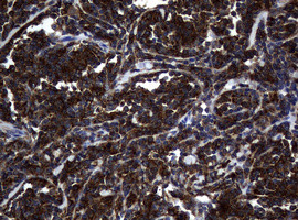 NME1 Antibody in Immunohistochemistry (Paraffin) (IHC (P))