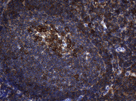 NME1 Antibody in Immunohistochemistry (Paraffin) (IHC (P))