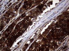 NME1 Antibody in Immunohistochemistry (Paraffin) (IHC (P))