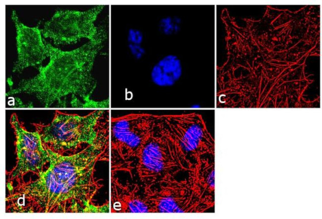 NME2 Antibody in Immunocytochemistry (ICC/IF)