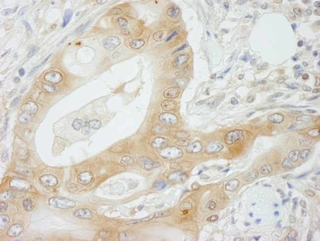 NMI Antibody in Immunohistochemistry (IHC)