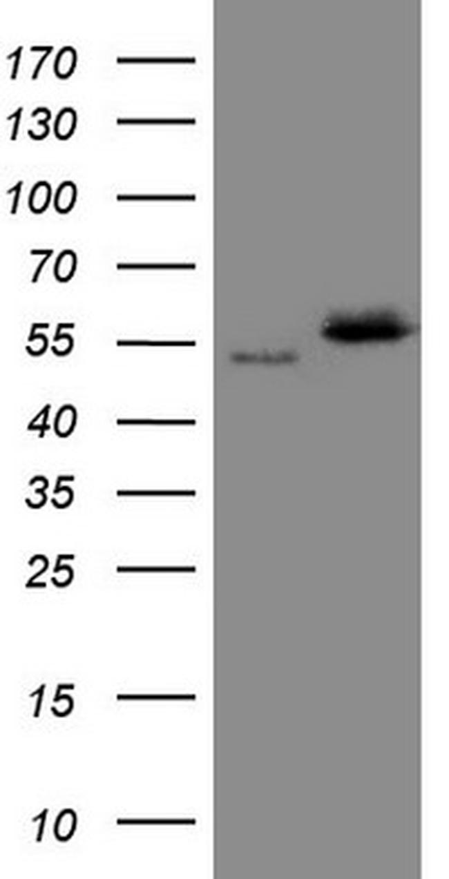 NOB1 Antibody in Western Blot (WB)
