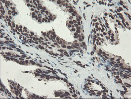 NONO Antibody in Immunohistochemistry (Paraffin) (IHC (P))